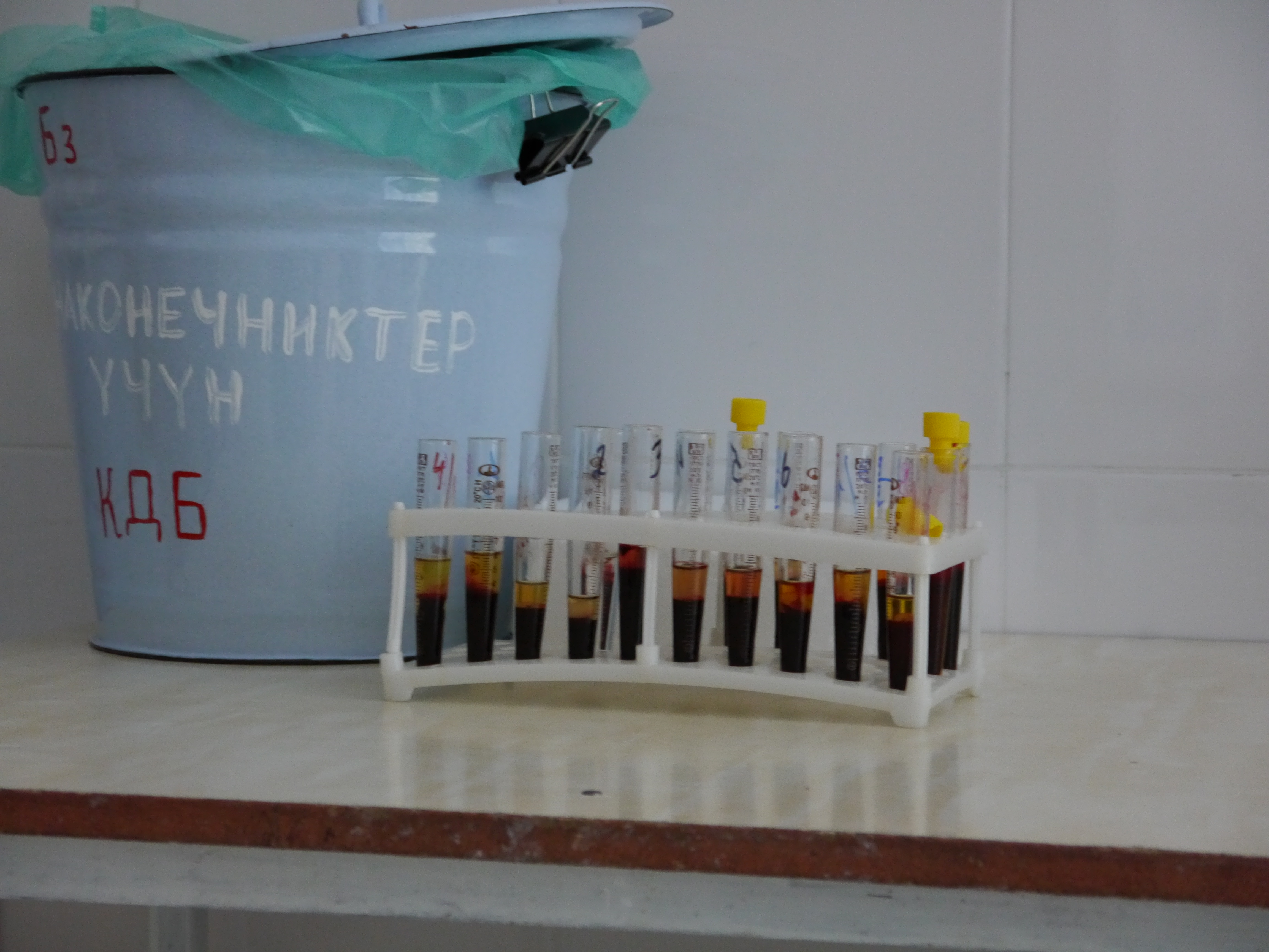 Knowledge, Attitudes and Practices toward Diabetic Kidney Disease among Type 2 Diabetes patients in Southern Kyrgyzstan